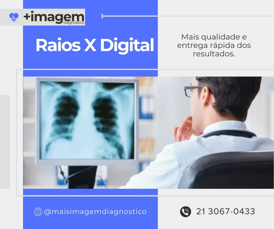 Imagem ilustrativa de Raios X